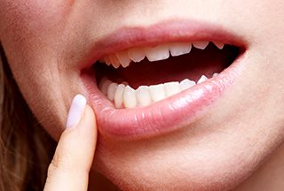 Ինչպես բուժել բերանի ստոմատիտը