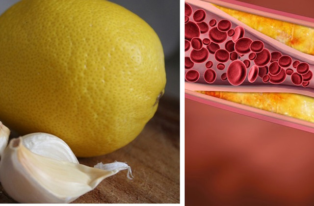 Մաքրեք անոթները