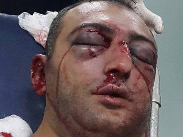 Մանրամասներ Քիմ Քարդաշյանի անվտանգությունը պահպանած աշխատակցի առողջական վիճակի վերաբերյալ