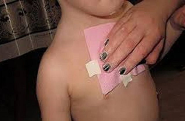 Մեղրով վիրակապեր՝ հազի և խորխի դեմ