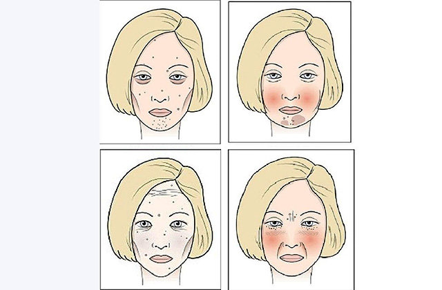 Որ մթերքներն են վնասում մաշկը