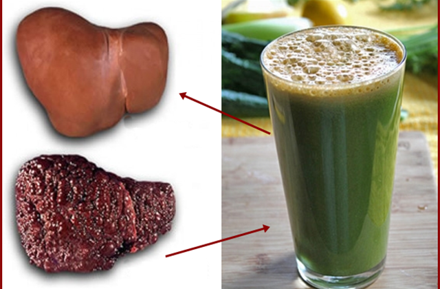 Լավագույն միջոցը՝ ճարպակալած լյարդի դեմ