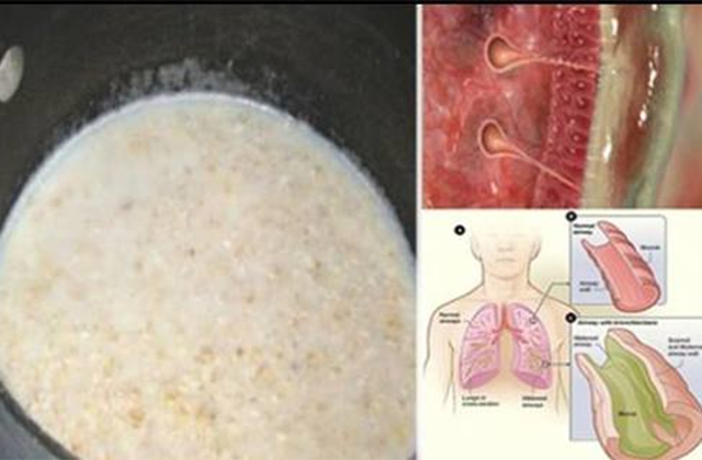 Տնական ըմպելիք, որը կլավացնի իմունիտետն ու թոքերից կհանի խորխը