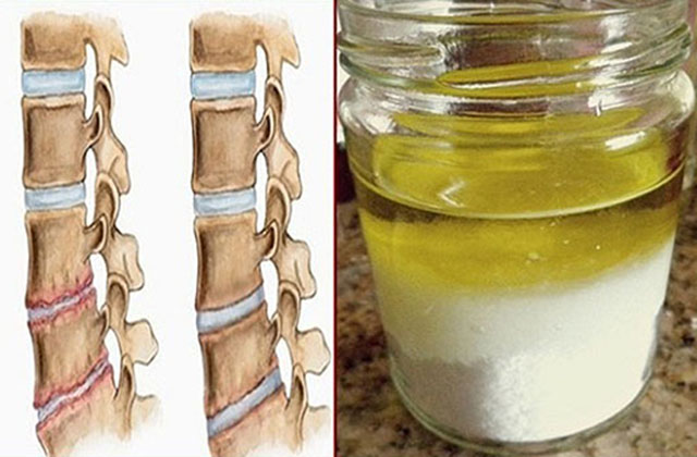 Ազատվեք տարիներ շարունակ ձեզ տանջող ցավից
