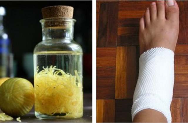 Վերացրեք հոդացավերը կիտրոնի կեղևի միջոցով