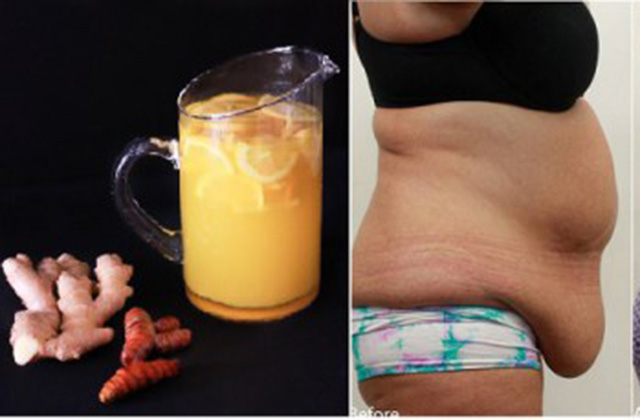 Ազատվեք մաշկի ավելորդ ճարպային գոյացություններից