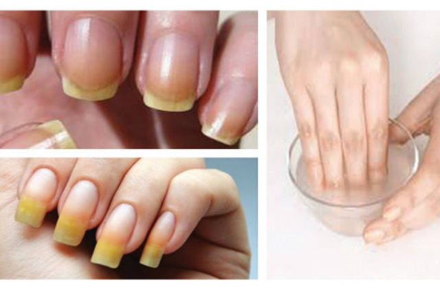 Եղունգների վիճակը լավացնելու մի քանի տարբերակ